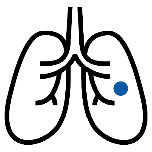 Icon of lungs showing inhalation