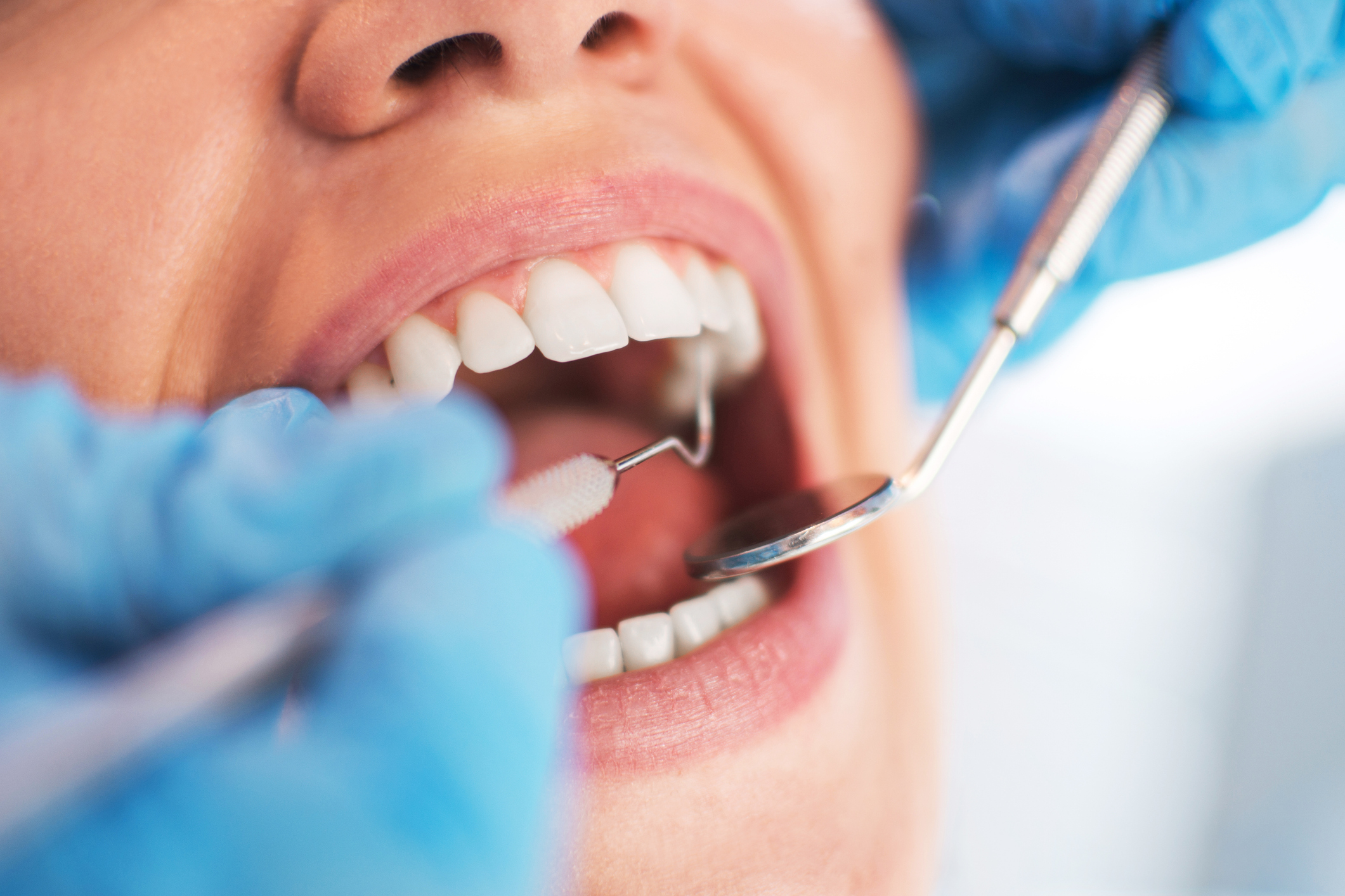 Image of person undergoing a dental examine.